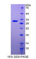 DDB2 Protein - Recombinant Damage Specific DNA Binding Protein 2 By SDS-PAGE