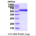DDC / DOPA Decarboxylase Protein