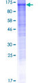 DDHD1 Protein - 12.5% SDS-PAGE of human DDHD1 stained with Coomassie Blue
