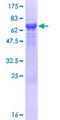 DDI1 Protein - 12.5% SDS-PAGE of human DDI1 stained with Coomassie Blue