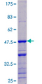 DDX17 Protein - 12.5% SDS-PAGE of human DDX17 stained with Coomassie Blue