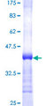 DDX19B Protein - 12.5% SDS-PAGE Stained with Coomassie Blue.