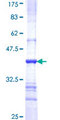 DDX20 / GEMIN3 Protein - 12.5% SDS-PAGE Stained with Coomassie Blue.