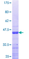 DDX24 Protein - 12.5% SDS-PAGE Stained with Coomassie Blue.
