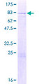 DDX28 Protein - 12.5% SDS-PAGE of human DDX28 stained with Coomassie Blue