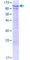 DDX42 Protein - 12.5% SDS-PAGE of human DDX42 stained with Coomassie Blue