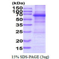 DDX56 Protein
