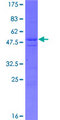DDX60 Protein - 12.5% SDS-PAGE of human FLJ20035 stained with Coomassie Blue