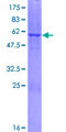 DHRS1 Protein - 12.5% SDS-PAGE of human DHRS1 stained with Coomassie Blue