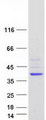DHRS1 Protein - Purified recombinant protein DHRS1 was analyzed by SDS-PAGE gel and Coomassie Blue Staining