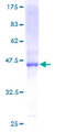 DHRS11 / MGC4172 Protein - 12.5% SDS-PAGE of human MGC4172 stained with Coomassie Blue