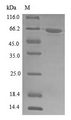 DHX9 Protein - (Tris-Glycine gel) Discontinuous SDS-PAGE (reduced) with 5% enrichment gel and 15% separation gel.