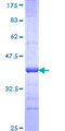 DIRAS2 Protein - 12.5% SDS-PAGE Stained with Coomassie Blue.