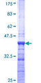 DMAP1 Protein - 12.5% SDS-PAGE Stained with Coomassie Blue