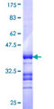 DMRTA3 / DMRT3 Protein - 12.5% SDS-PAGE Stained with Coomassie Blue.