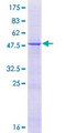 DNAAF5 / HEATR2 Protein - 12.5% SDS-PAGE of human HEATR2 stained with Coomassie Blue