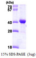 DNAJB2 Protein