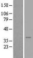 DNAJB7 Protein - Western validation with an anti-DDK antibody * L: Control HEK293 lysate R: Over-expression lysate