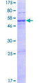 DNAJC22 / FLJ13236 Protein - 12.5% SDS-PAGE of human FLJ13236 stained with Coomassie Blue