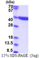 DNAJC27 Protein