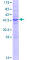 DNAJC5G Protein - 12.5% SDS-PAGE of human DNAJC5G stained with Coomassie Blue