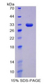 DNMT / DNMT1 Protein - Recombinant DNA Methyltransferase 1 By SDS-PAGE