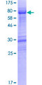 DNTNP / FAM53A Protein - 12.5% SDS-PAGE of human FAM53A stained with Coomassie Blue