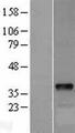 DOK5 Protein - Western validation with an anti-DDK antibody * L: Control HEK293 lysate R: Over-expression lysate