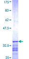 DOK5 Protein - 12.5% SDS-PAGE Stained with Coomassie Blue.