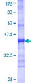 DPH2 Protein - 12.5% SDS-PAGE Stained with Coomassie Blue.