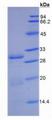 DPP4 / CD26 Protein - Recombinant Dipeptidyl Peptidase IV By SDS-PAGE
