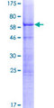 DPPA4 Protein - 12.5% SDS-PAGE of human DPPA4 stained with Coomassie Blue