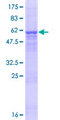 DRIP1 / C14orf28 Protein - 12.5% SDS-PAGE of human C14orf28 stained with Coomassie Blue
