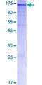DSG1 / Desmoglein 1 Protein - 12.5% SDS-PAGE of human DSG1 stained with Coomassie Blue