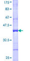DTNB / Dystrobrevin Beta Protein - 12.5% SDS-PAGE Stained with Coomassie Blue.