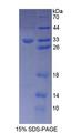 DTNB / Dystrobrevin Beta Protein - Recombinant  Dystrobrevin Beta By SDS-PAGE