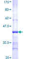 DTX3 Protein - 12.5% SDS-PAGE Stained with Coomassie Blue.