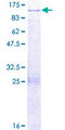 DUS3L Protein - 12.5% SDS-PAGE of human DUS3L stained with Coomassie Blue