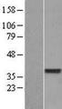 DUS4L Protein - Western validation with an anti-DDK antibody * L: Control HEK293 lysate R: Over-expression lysate