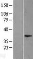 DUSP11 Protein - Western validation with an anti-DDK antibody * L: Control HEK293 lysate R: Over-expression lysate
