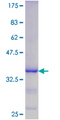 DUSP11 Protein - 12.5% SDS-PAGE Stained with Coomassie Blue.