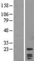 DYDC1 Protein - Western validation with an anti-DDK antibody * L: Control HEK293 lysate R: Over-expression lysate