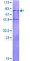 DYX1C1 Protein - 12.5% SDS-PAGE of human DYX1C1 stained with Coomassie Blue