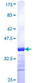 DYX1C1 Protein - 12.5% SDS-PAGE Stained with Coomassie Blue.