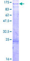 DZIP1 Protein - 12.5% SDS-PAGE of human DZIP1 stained with Coomassie Blue