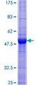 EBI3 / IL-27B Protein - 12.5% SDS-PAGE of human EBI3 stained with Coomassie Blue