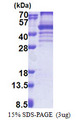 EBNA1BP2 Protein