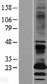 EBPL Protein - Western validation with an anti-DDK antibody * L: Control HEK293 lysate R: Over-expression lysate