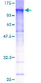 ECD Protein - 12.5% SDS-PAGE of human HSGT1 stained with Coomassie Blue