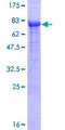 EED Protein - 12.5% SDS-PAGE of human EED stained with Coomassie Blue